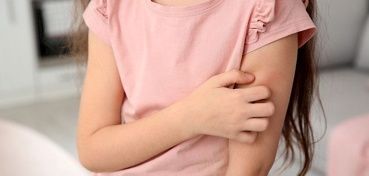 Allergiat voivat helpottaa tai väistyä iän myötä