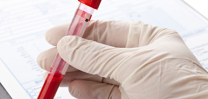 Korkea hemoglobiini — onko se vaarallista?
