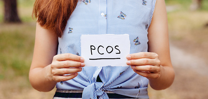 PCOS eli munasarjojen munarakkulaoireyhtymä on yleinen hormonihäiriö — nämä ovat sen oireet