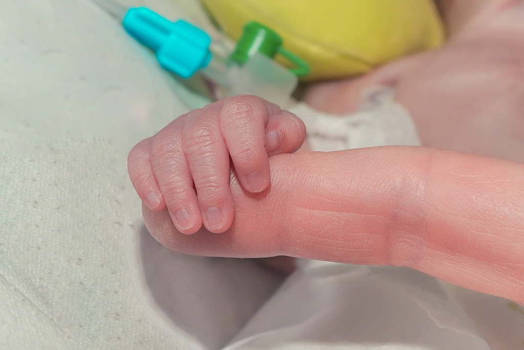 Yllätyksenä tutkijoille tuli, että maanantaina syntyneiden pikkukeskosten kuolleisuus oli merkitsevästi suurempaa kuin muina päivinä syntyneiden.