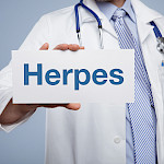 Genitaaliherpes – yleinen mutta usein oireeton sukupuolitauti