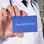 Valkoinen muutos suun limakalvolla voi olla leukoplakia
