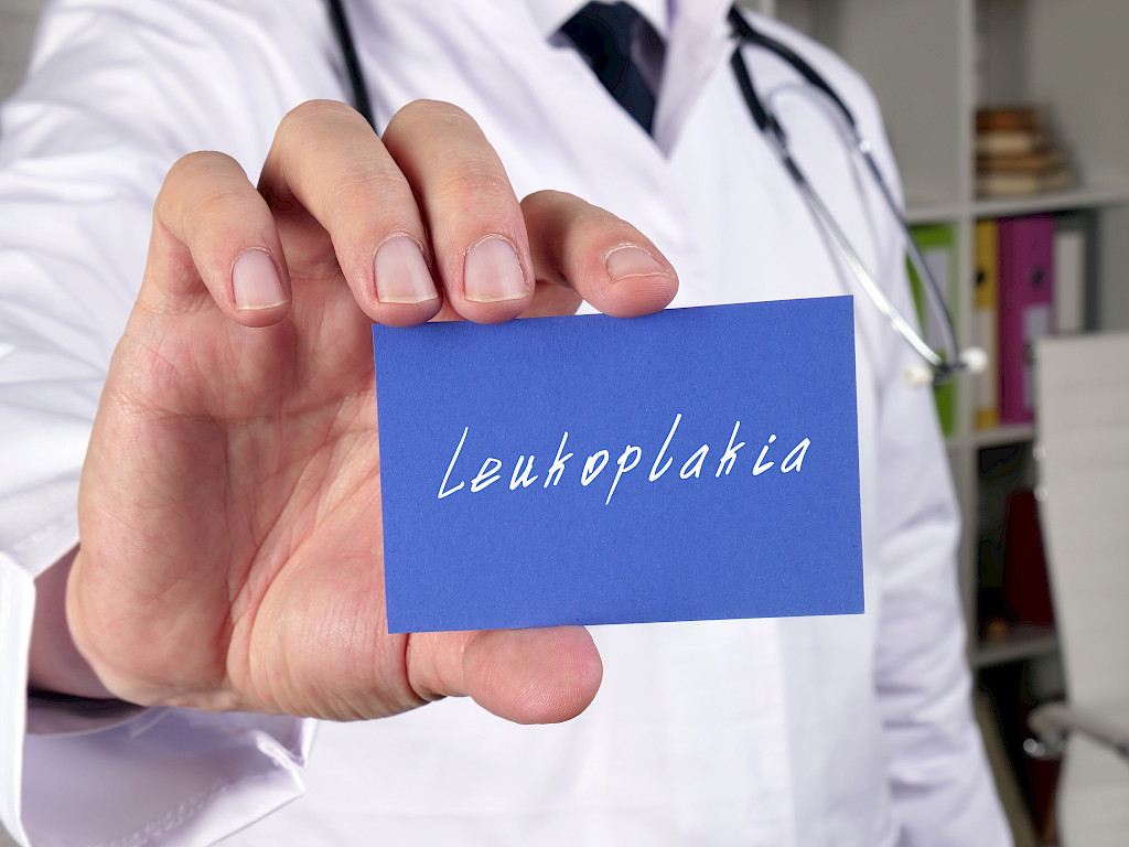 Leukoplatia johtuu useimmiten suun limakalvon ärsytyksestä.