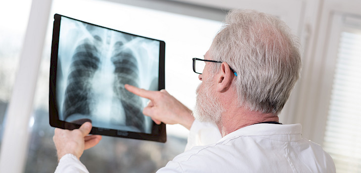 Keuhkokuume — tunnista oireet ajoissa