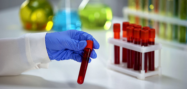 Mistä anemia johtuu?