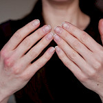 Käsien voimattomuus tai kömpelyys – milloin syy pitää selvittää?